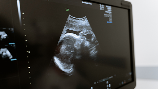 Target product profile for obstetric ultrasound devices