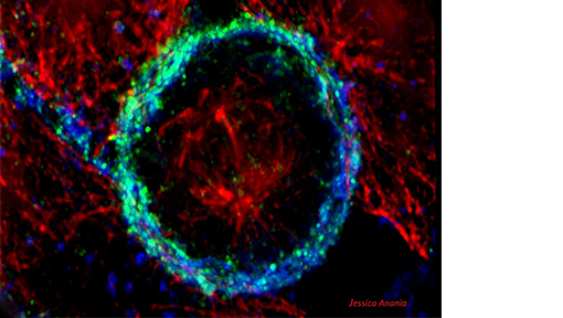 Fc receptor targeted treatments in inflammation and allergy