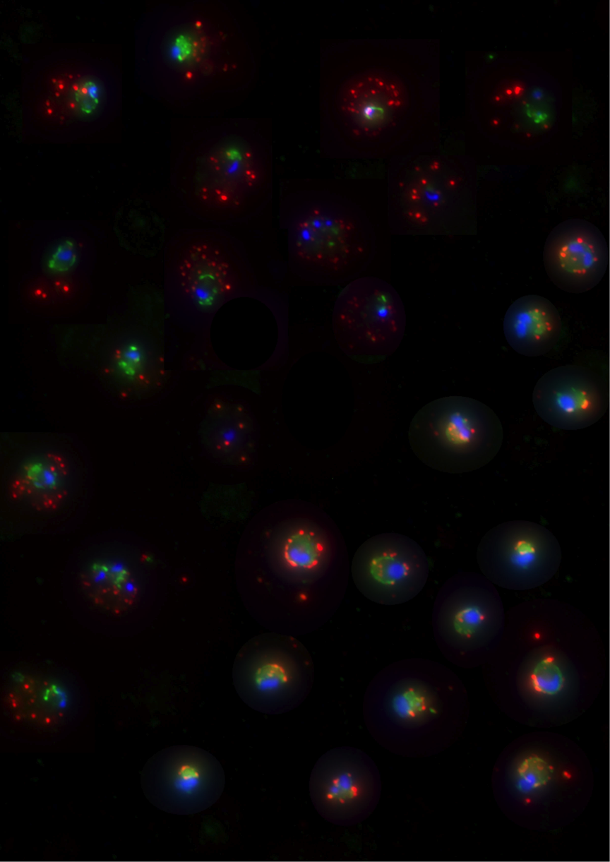 Vaccines against malaria caused by Plasmodium falciparum and P. vivax